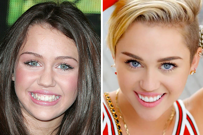 Celebrity Smile: Miley Cyrus - Dr. Monica Crooks, D.D.S